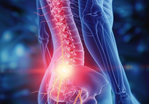 Anticonvulsants for Nerve Pain: A Comprehensive Guide